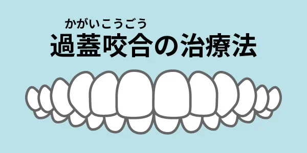 過蓋咬合の治療法