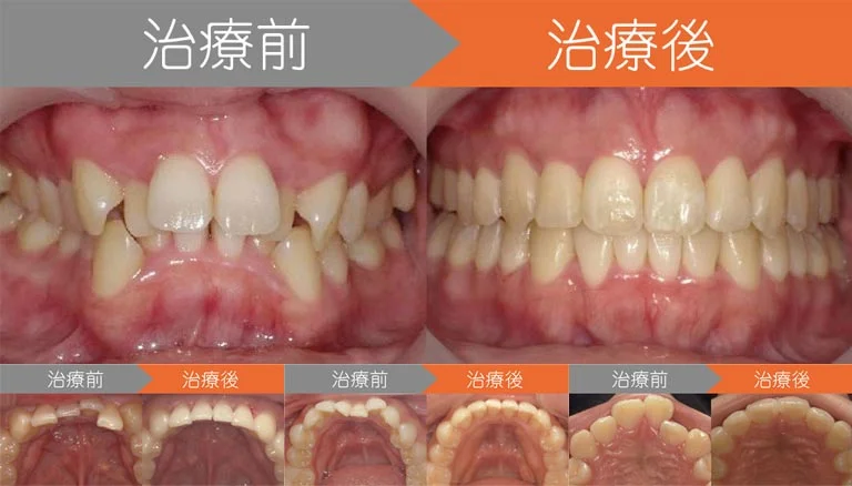 1. 自分の希望や目的を整理する