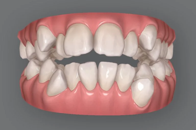 3Dシミュレーション