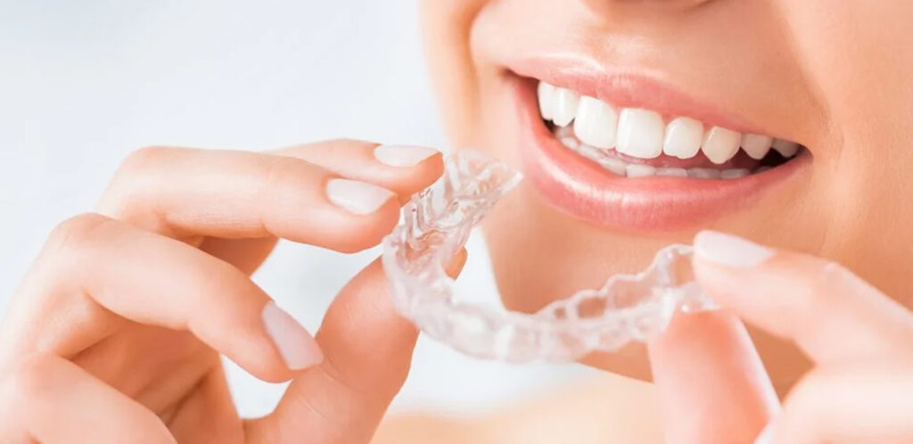 矯正メニュー・費用