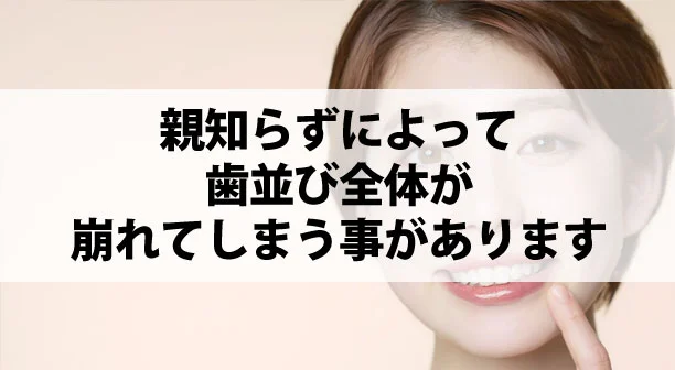 歯のメカニズム