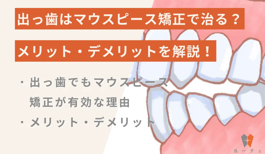 出っ歯はマウスピース矯正で治る？メリット・デメリットを解説