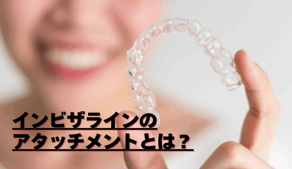 インビザラインのアタッチメントとは？