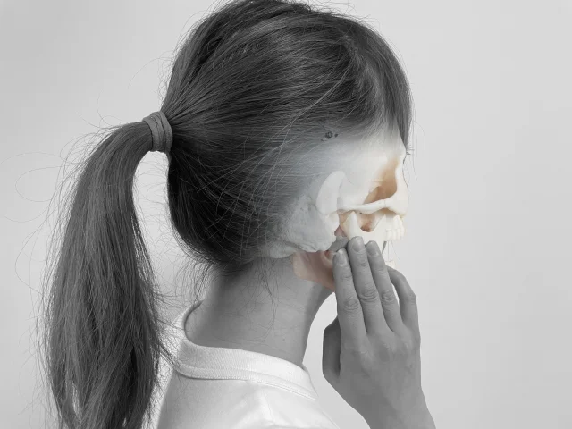 マウスピース矯正　顎関節症