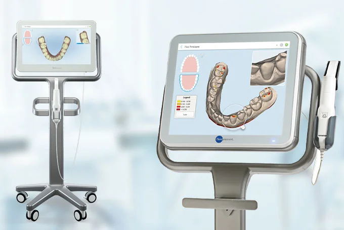 3-3d (1) - ルーチェマウスピース矯正歯科 3D治療計画(クリンチェック)