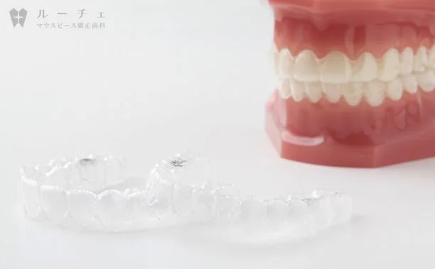 image - ルーチェマウスピース矯正歯科 マウスピース矯正がおすすめ