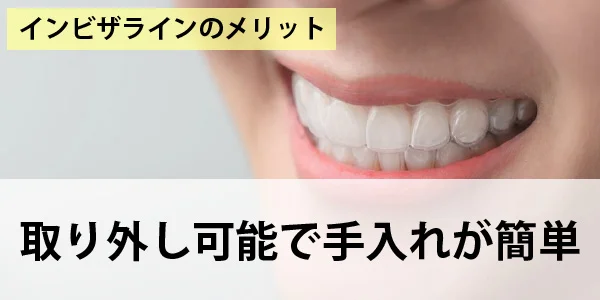 取り外し可能で手入れが簡単