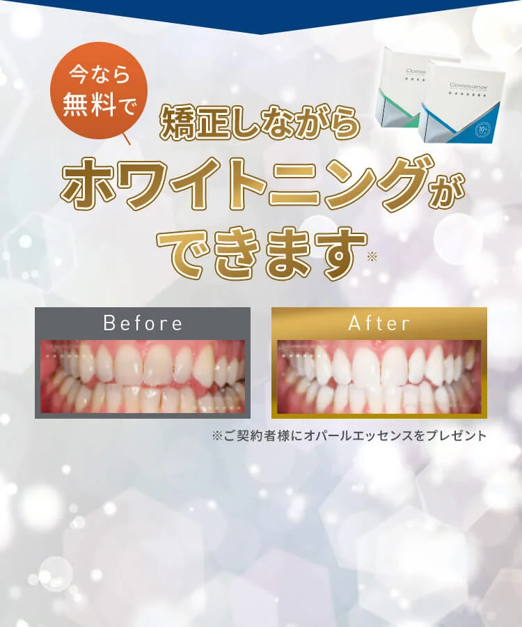 image - ルーチェマウスピース矯正歯科 ホワイトニングができます