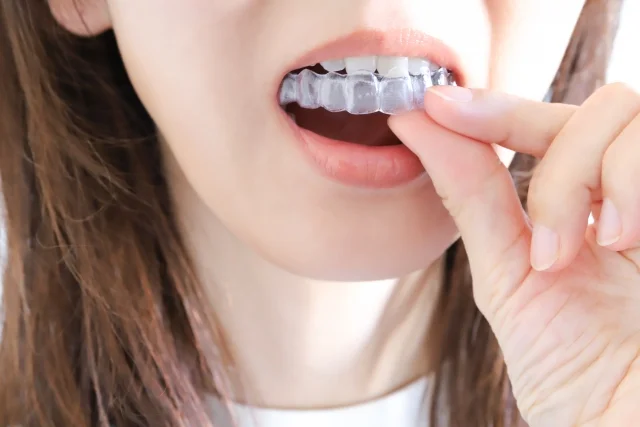 image - ルーチェマウスピース矯正歯科 リテーナーの装着期間について