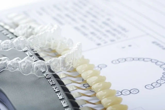 マウスピース矯正とホワイトニングは同時にできる？