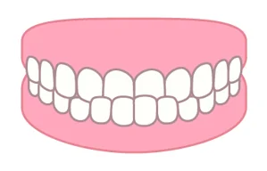 下顎前突（かがくぜんとつ／いわゆる受け口）