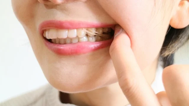 ゴムかけのよくある質問