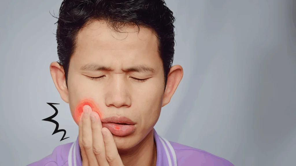 image - ルーチェマウスピース矯正歯科 インビザライン治療中に口内炎ができる原因とは?