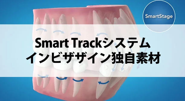 Smart Track