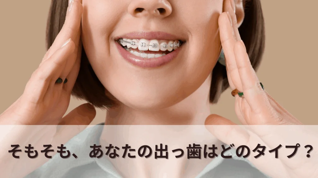 そもそも、あなたの出っ歯はどのタイプ？
